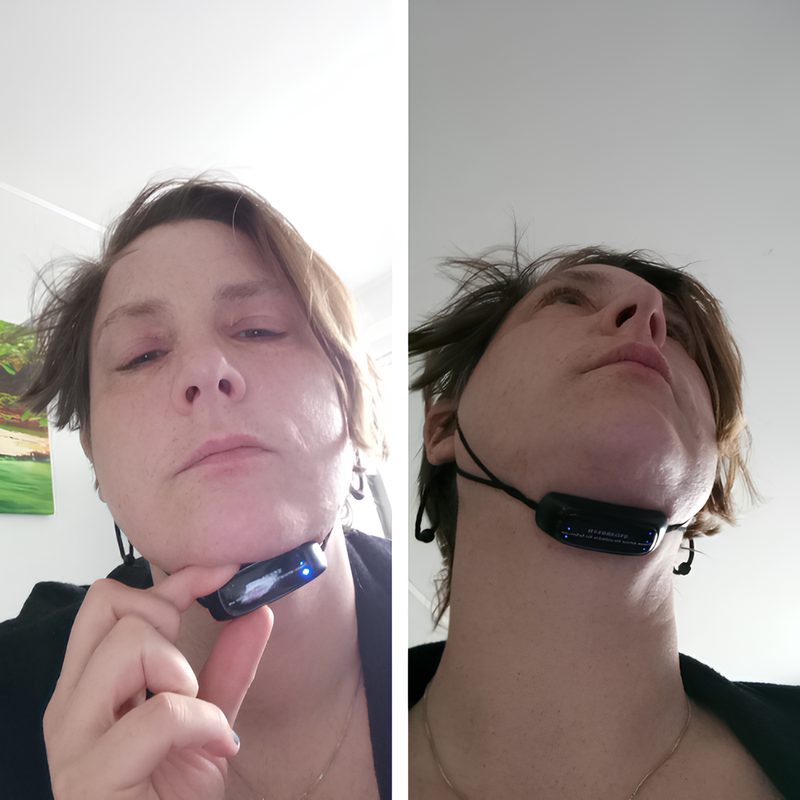 🔥 40% OFF Today – FaceLift™ Double Chin & Wrinkle Remover ✨ Visible Results in 14 Days + FREE Firming Cream 💕