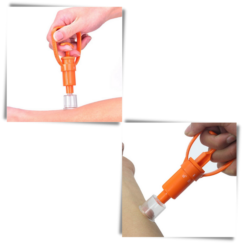 Emergency Venom Extractor Kit