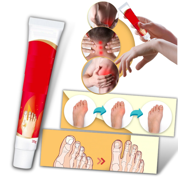 Anti-inflammatory Bunion Cream