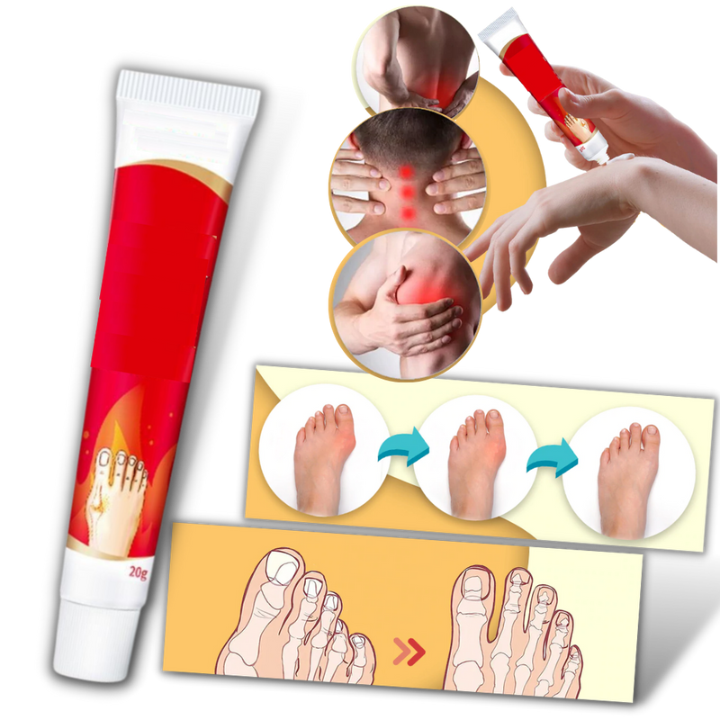 Anti-inflammatory Bunion Cream