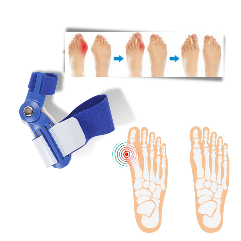 Orthopaedic Bunion Corrector
