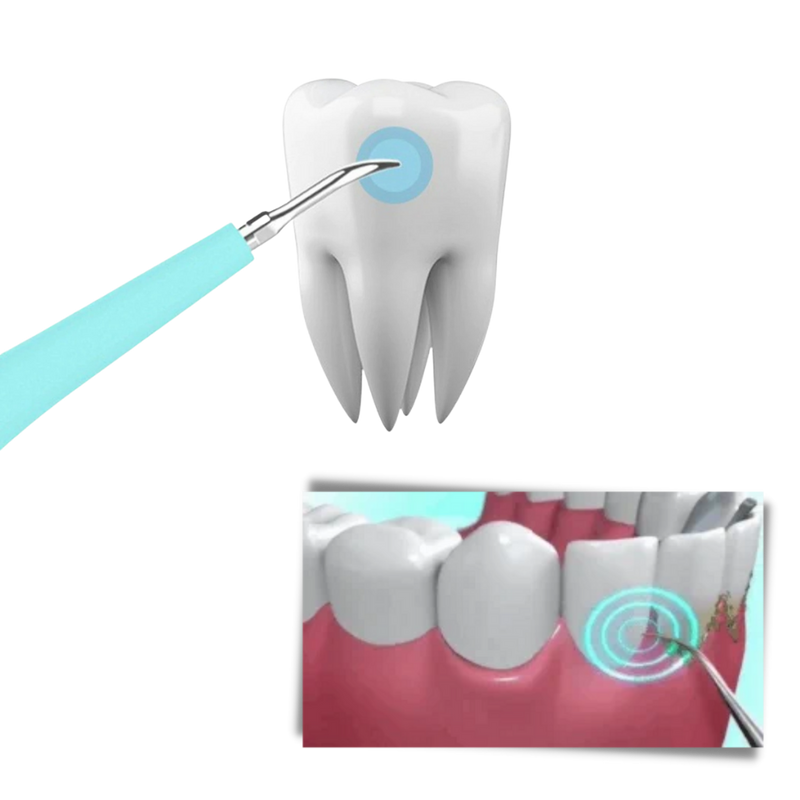 Deep Cleaning Tooth Tartar Machine