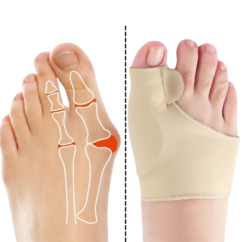 Gel bunion corrector
