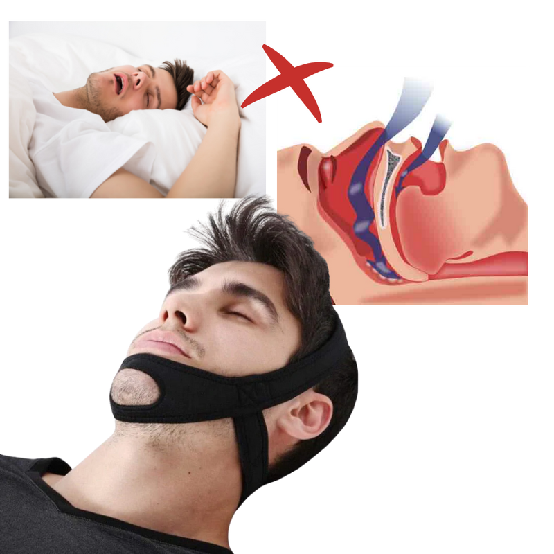 Snore Prevention Strap