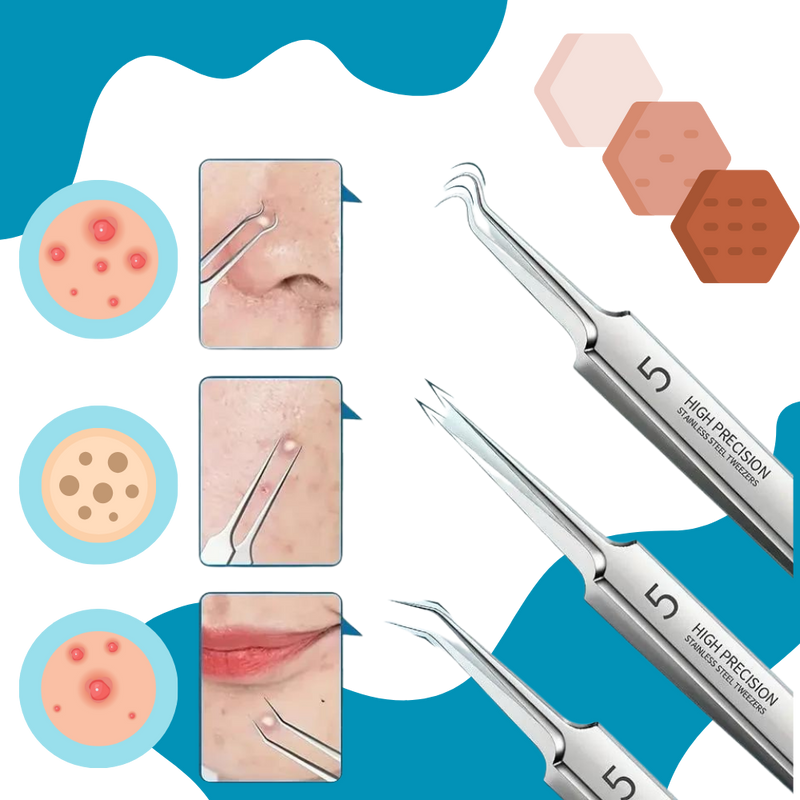 Ultra Precision Pointed Tweezers